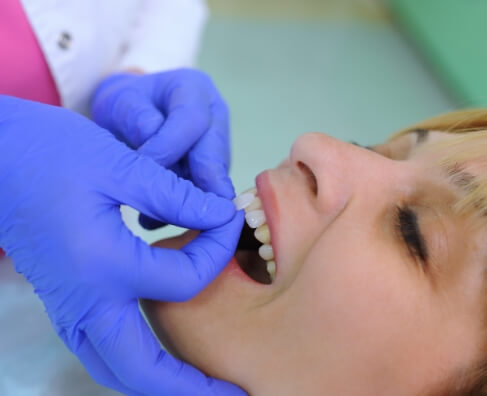 Dentist in blue gloves examining patient's teeth during dental checkup appointment.