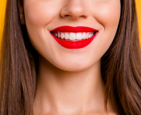 Woman smiling brightly with red lipstick against yellow background for dental practice.