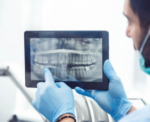 Dentist in blue gloves examining dental X-ray on tablet screen in clinical setting.