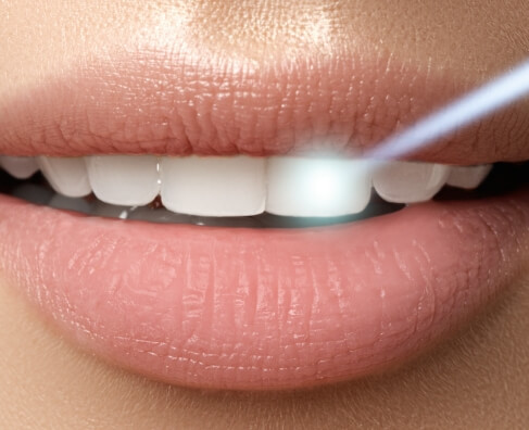 Close-up of a person's smile showing white teeth and natural pink lips during dental examination or treatment.