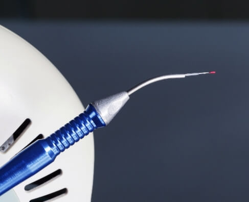 Dental ultrasonic scaler with blue handle positioned against white surface and dark background.