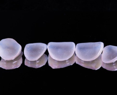 Five translucent dental crowns arranged in a row against black background