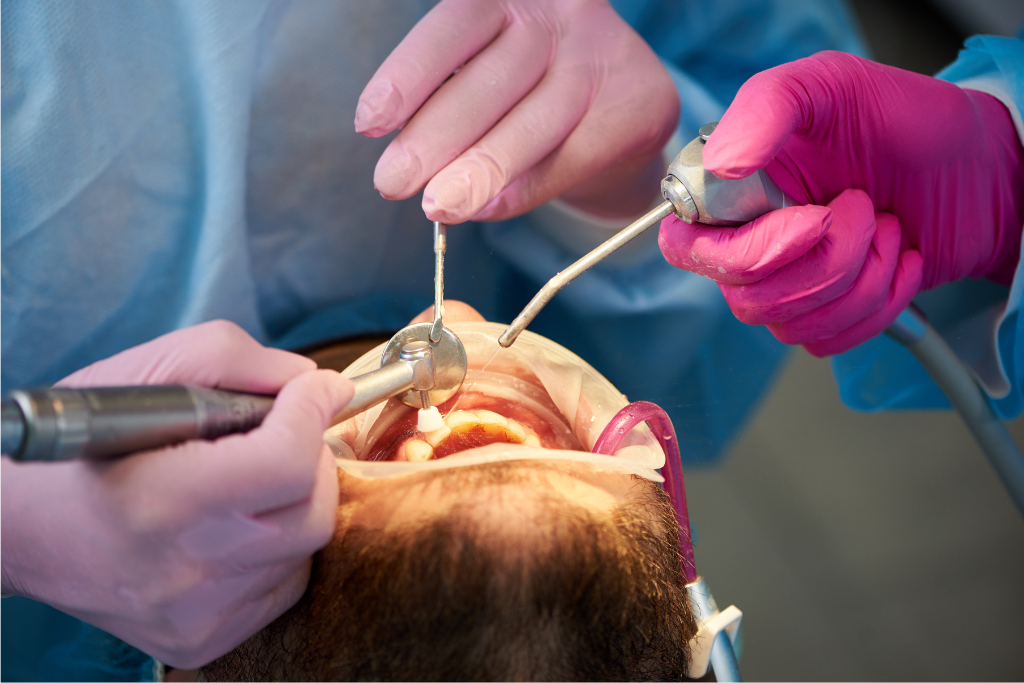 Close up of dentist performing a dental procedure