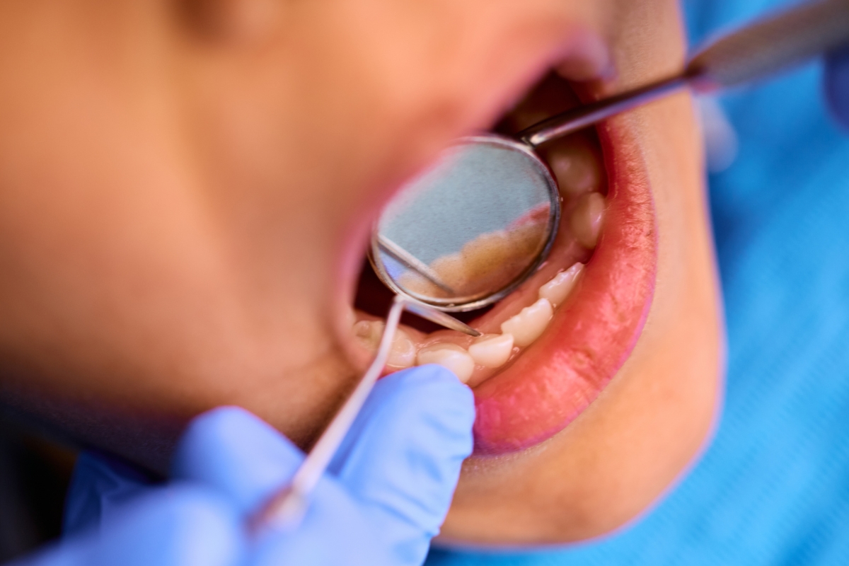 Dentist examining a patient with a severe toothache for emergency dental care